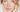 Sensitive Skin: Unravelling the Causes and Finding Effective Treatments - AINMHÍ