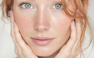 Sensitive Skin: Unravelling the Causes and Finding Effective Treatments - AINMHÍ