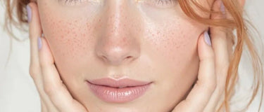 Sensitive Skin: Unravelling the Causes and Finding Effective Treatments - AINMHÍ